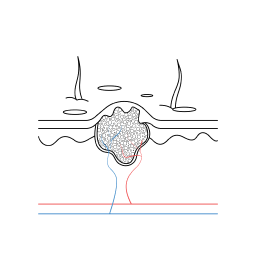 zdorwa skora vs zmiany 03 1