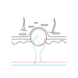 zdorwa skora vs zmiany 03 1